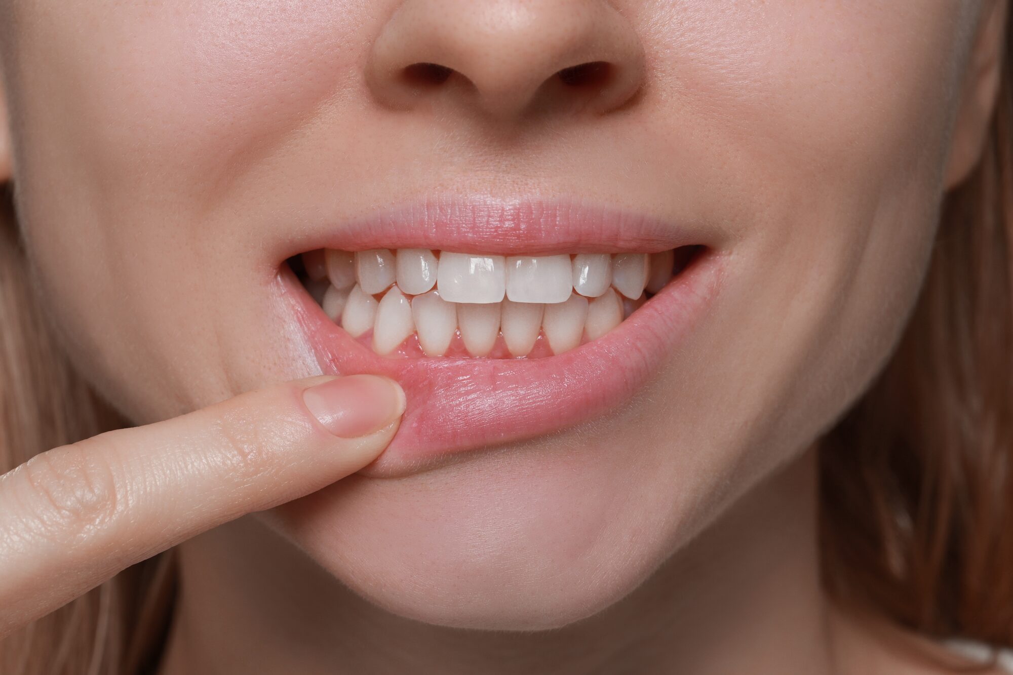 land o' lakes dental implants