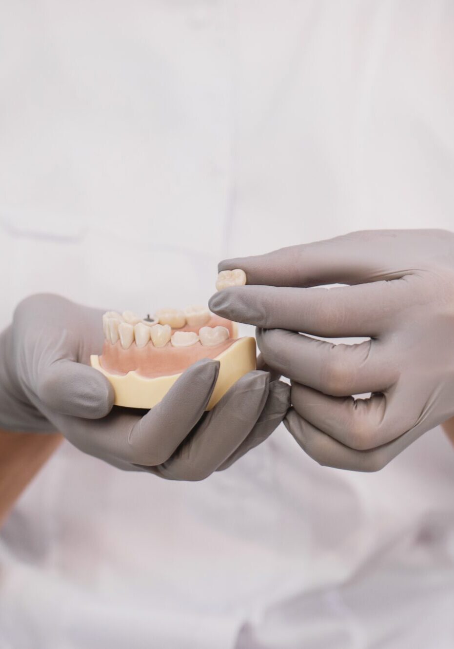 All-on-X Implants in Land O' Lakes, FL